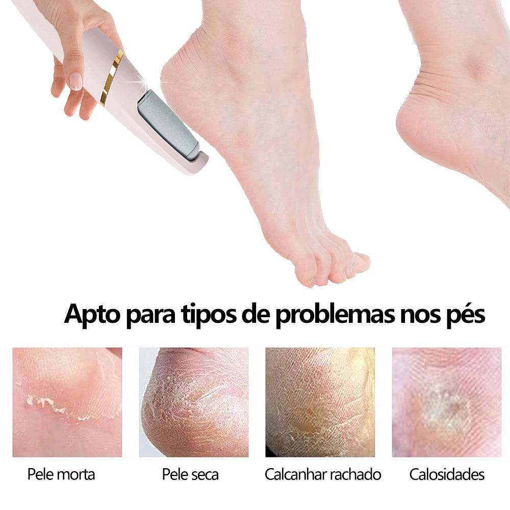 Lixa Elétrica para os Pés Soft Skin